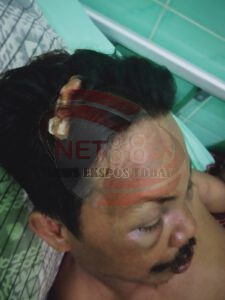 Kapolres Situbondo Berharap Dugaan Kasus 170 Diproses Secara Profesional dan Sesuai Prosedur