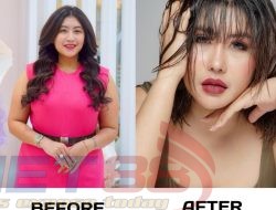 Operasi Kedua di Korea Selatan, Aprilia Sky Tampil Lebih Muda dan Percaya Diri