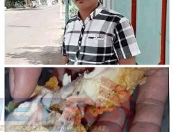 Menu MBG Berulat di Saronggi, SPPG Bungkam, Pendampingan Dipertanyakan